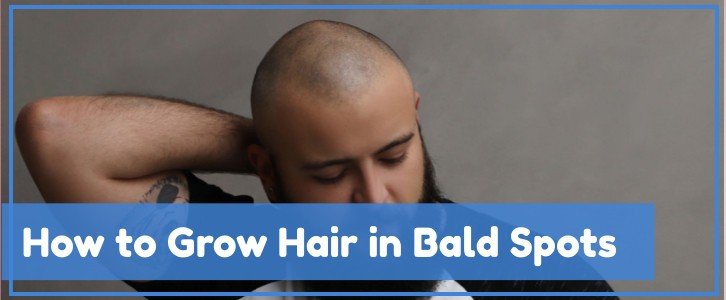 how to grow hair in bald spots