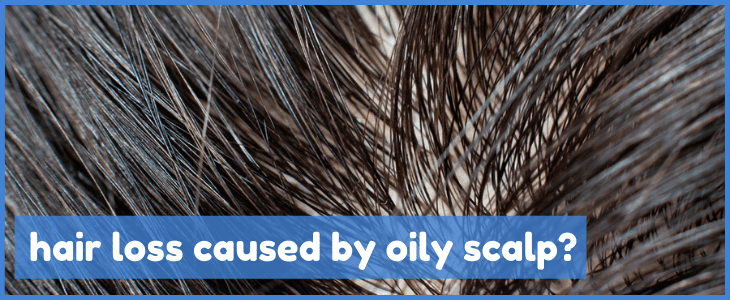 oily scalp hair loss featured image